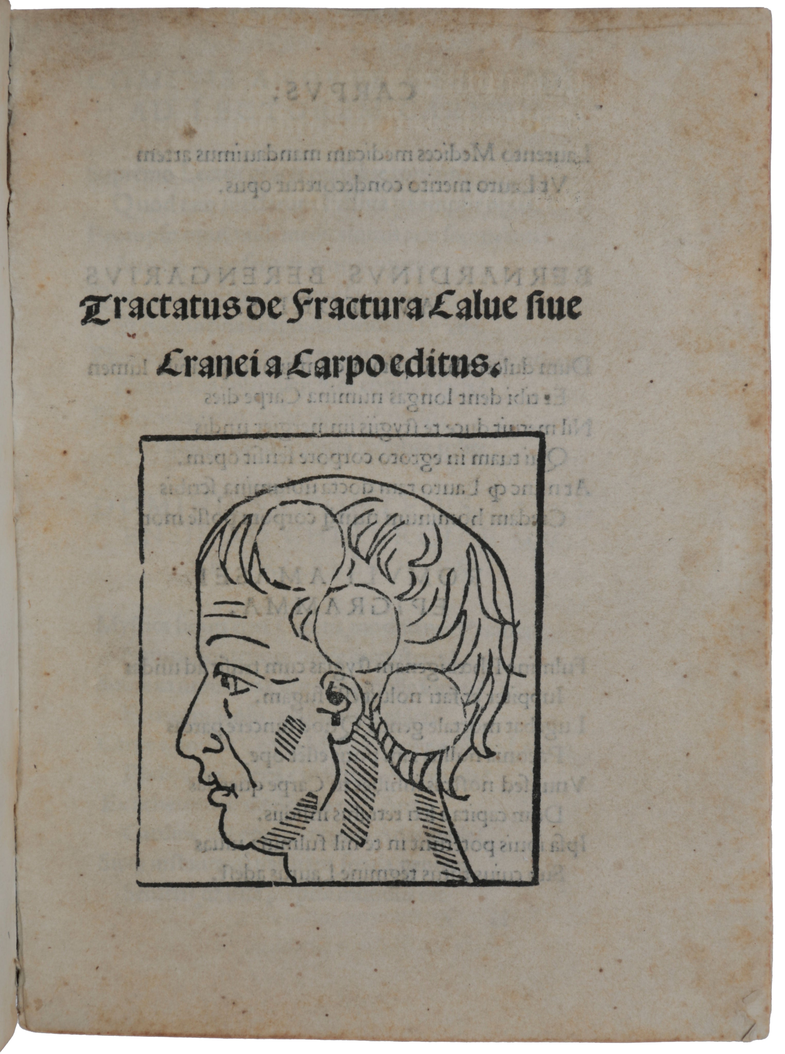Item #5182 Tractatus de Fractura Calve sive Cranei. Jacopo BERENGARIO da CARPI.