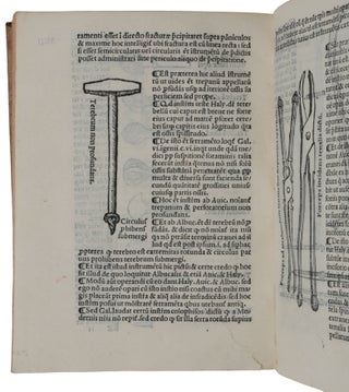 Tractatus de Fractura Calve sive Cranei.