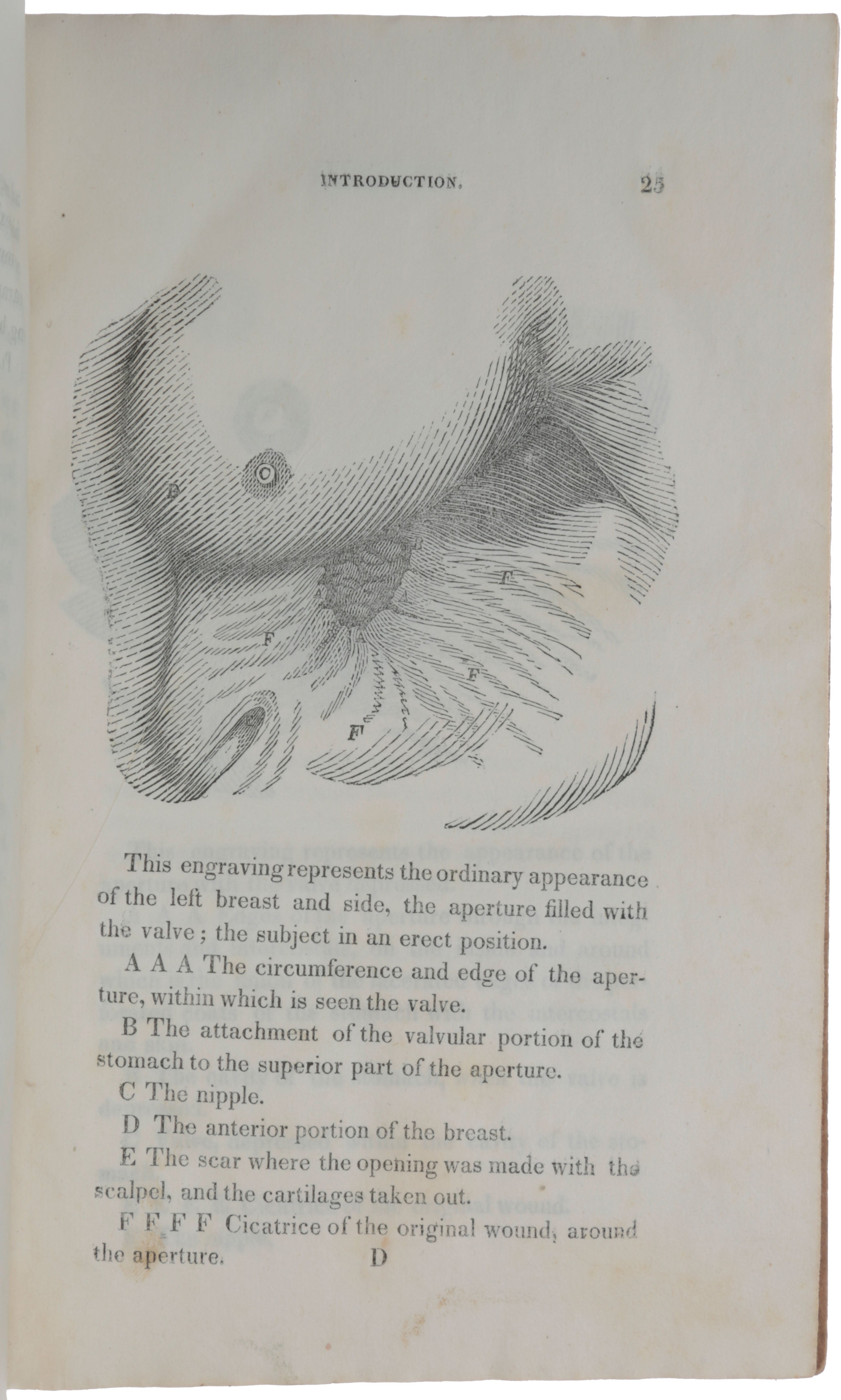 Experiments and Observations on the Gastric Juice and the Physiology of Digestion by William BEAUMONT on SOPHIA RARE BOOKS