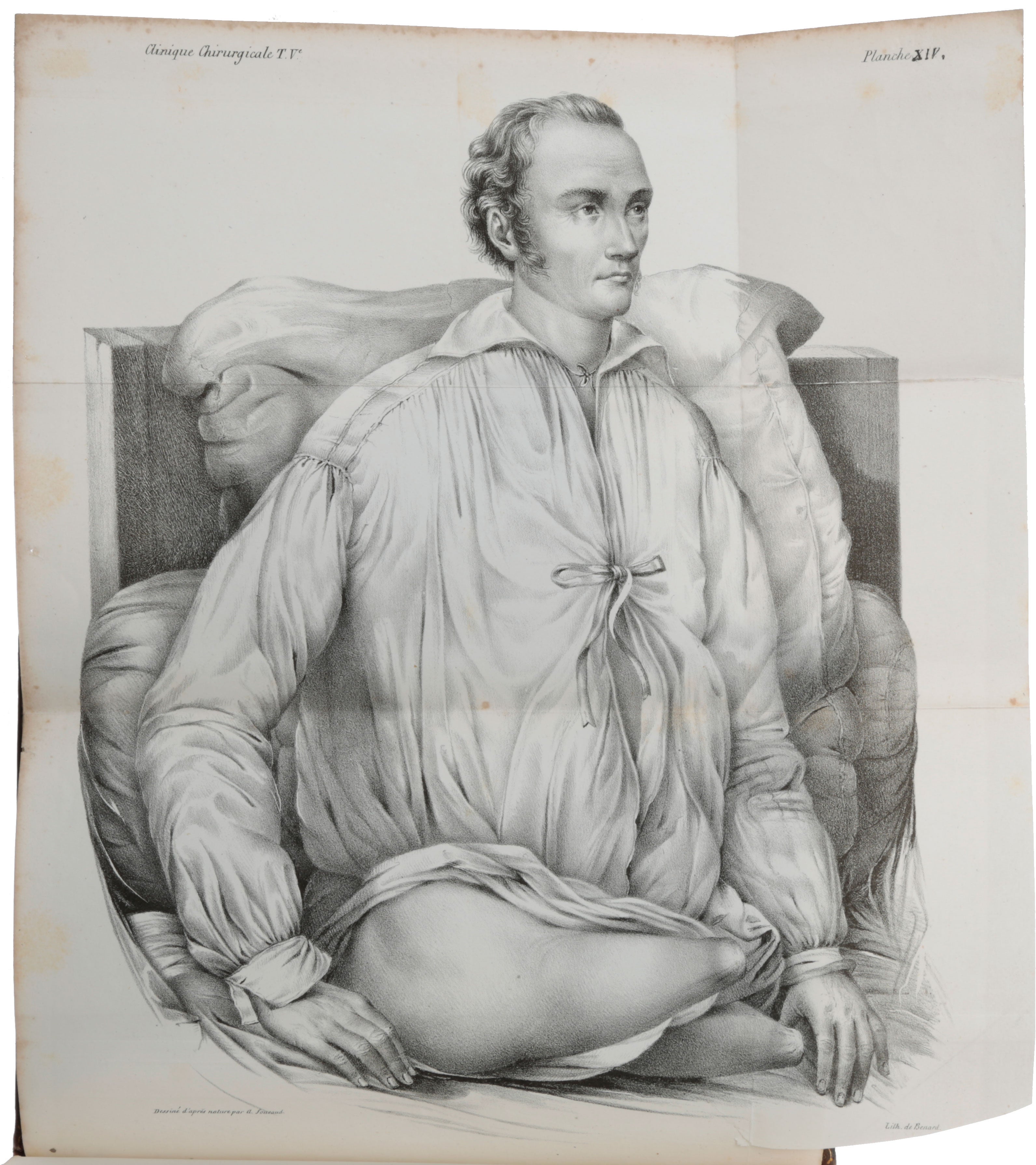 Item #5782 Clinique chirurgicale, exercée particulierement dans les camps et les hopitaux militaires, depuis 1702 jusqu’en 1829. Dominique Jean LARREY, Baron.