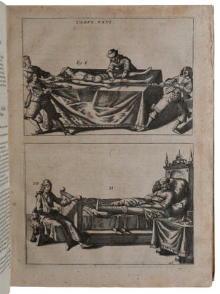Χειροπλοθήκη, seu armamentarium chirurgicum XLIII. tabulis aeri elegantissime incisis, nec ante hac visis, exornatum. Opus posthumum, Medicinae pariter ac Chirurgiae Studiosos perutile & necessarium, in quo tot, tam veterum ac recentiorum instrumenta ab authore correcta, quàm noviter ab ipso inventa, quot ferè hodie ad usitatas operationes manuales feliciter peragendas requiruntur, iusta & hac tenus semper desiderata magnitudine & applicandi modo, depicta reperiuntur, cum annexa brevi Tabularum descriptione, & sequentibus cautionibus ac curationibus Chirurgico-Medicis per omnes ferè corporis humani partes externas observatis.
